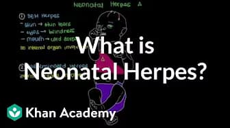 Infectious diseases | NCLEX-RN | Khan Academy